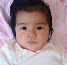 Gracias Brenda por la confianza! #Rinoplastía cerrada con #Umbrellatipgraft  en paciente que presentaba giba dorsal y punta caída. ✍Av. Arequipa 360,  Santa Beatriz