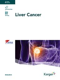 Symptoms of liver cancer can include: The Burden And Trends Of Primary Liver Cancer Caused By Specific Etiologies From 1990 To 2017 At The Global Regional National Age And Sex Level Results From The Global Burden Of Disease
