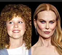 This how mfs be looking after they get bit by a vampire.