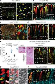 On the epiphyseal side of the epiphyseal plate, cartilage is formed. A Radical Switch In Clonality Reveals A Stem Cell Niche In The Epiphyseal Growth Plate Nature