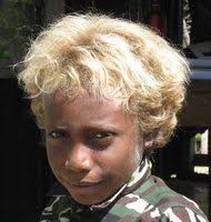 Island S Genetic Quirk Dark Skin Blond Hair Black And Blonde Blonde Blonde Hair