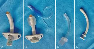 Image result for Tracheostomy