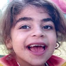 Sanfilippo Syndrome Wikipedia