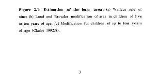 25(weight in kg) + 40(tbsa) age >60: Https Core Ac Uk Download Pdf 37027925 Pdf