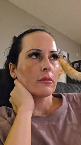 Embracing Bare Skin: My Journey to Clearer Complexion