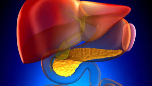 The lowest stages indicate that the cancer is confined to the pancreas. Blood Test Might Spot Pancreatic Cancer Early Consumer Health News Healthday