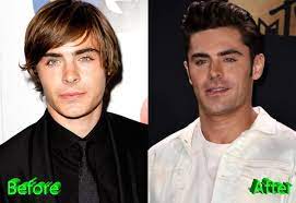 Fans took to twitter to question why zac efron looks different in a new clip for bill nye's earth day musical special with facebook watch. Zac Efron Plastic Surgery A New Look For Teen Heartthrob