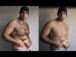 The loss and thinning out of body hair seems to be a result of ageing in general than it is of estrogen deficiency in particular; Brutal Hairloss How To Lose Your Bodyhair In A Few Minutes Youtube