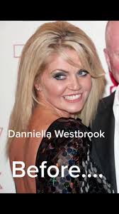 Daniella Westbrook Before and After