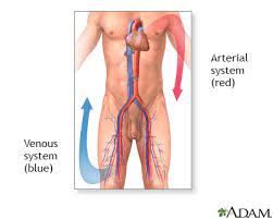Deep Vein Thrombosis Information Mount Sinai New York