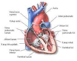 Penyakit jantung koroner, yaitu penyakit jantung yang terjadi akibat penyempitan pembuluh darah di jantung. Serangan Jantung Wikipedia Bahasa Indonesia Ensiklopedia Bebas