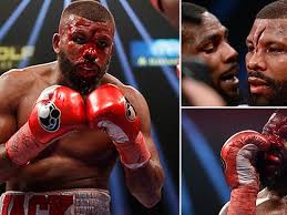 Jack suffered a horrible cut on his forehead in round 7, and he had to fight with his vision obscured in the last five rounds of the contest. Positive Psychology Badou Jack Bad Cut From Headbutt