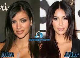 Kim Kardashian Nose Job Before And After Nose Job Kim Kardashian Before Kardashian Plastic Surgery