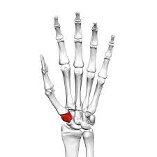 The tmc joint, at the base of the thumb, can be one of the most debilitating places to develop arthritis, but also one of the most common. Ortho Rhode Island