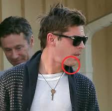 Zac efron is not your eye candy. Try Living Safari Pictured Zac Efron Displays Swollen Face And Large Scar On His Chin After Accident Which Saw His Jaw Wired Shut