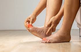 Image result for Edema