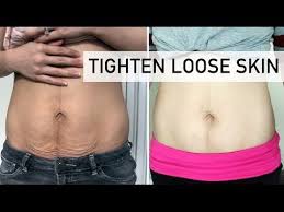 Miracle Serum Tighten Loose Skin Fade Wrinkles Fountain Of Youth Tighten Loose Skin Loose Skin Skin Tightening Stomach