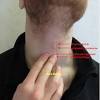 Raising their head and turning it to the side can help gravity to drain the secretions. 1