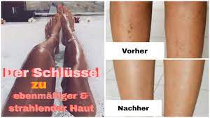 meine tipps gegen dunkle flecken eingewachsene harre erdbeerbeine k eingewachsene haare beine dunkle flecken beauty tipps