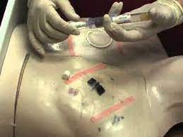 Home Health Skills Part 4 - Lab Draw From Central Line Ii - Youtube