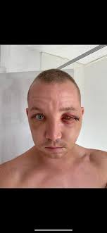 LDA our sister NA group 5 year anniversary...love you family..... We do  recover ❤