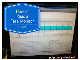 how to read a fetal monitor in labor