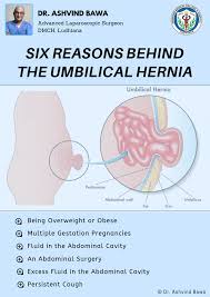 Pin On Hernia Awareness