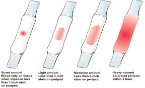 Around 1 in 4 pregnant women have some light bleeding very spotting or light bleeding is probably from something minor, but it could also be a sign of a serious problem, such as an ectopic pregnancy, a. Fresh 25 Of What Does Light Bleeding During Pregnancy Look Like Phenterminecodjkr
