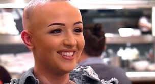 First Dates' alopecia sufferer Eve Betts hailed after removing wig onscreen 