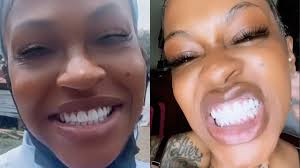 Here's the Tea about Lil Mo's fabulous new teeth! GaryWithDaTea.com  #GarysTea
