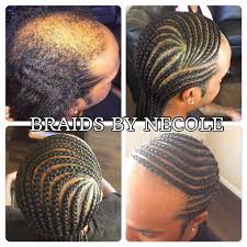 14 Extraordinary Alopecia Camouflage Cornrows By Braids By Necole Braids For Thin Hair Crochet Braids Marley Hair Alopecia Hairstyles