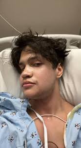 1 day post double jaw surgery ama : r/jawsurgery