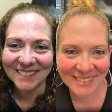 Best 30 Physicians Surgeons Dermatology in Lancaster, PA with Reviews