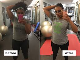 The first 24 hours after botox are the most important. I Tried Botox For Sweating And Haven T Used Antiperspirant For Months Self