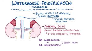 Waterhouse Friderichsen Syndrome Video Explanation Osmosis