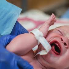 Herpes simplex virus (hsv) is a virus that usually causes skin infections. New York Mohel Accused Of Infecting Infant With Herpes During Circumcision