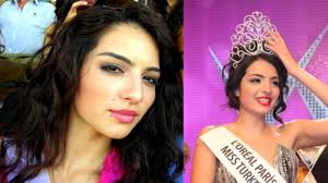 Deren talunun estetiksiz hali şoke etti deren talu meğer. Melisa Asli Pamuk Estetik Yaptirdi