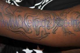 The definition is, the scar is much larger than the original site of the wound. Tattoo Keloid Cream Tattoo Design