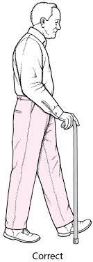 Je suis surprise qu'autant de personnes me demandent comment allez vous ? c'est en effet a peu près la question d'un message sur deux que je reçois. Troubles De La Marche Chez Les Personnes Agees Geriatrie Edition Professionnelle Du Manuel Msd