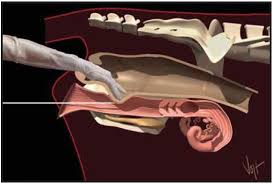 Biotechnology In Cattle Artificial Insemination Artificial Insemination Cattle Veterinary Science