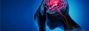 Zu Viel Schlaf Kann Das Schlaganfallrisiko Steigern Medical Tribune