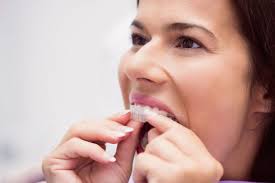Maintaining Your Clear Aligner Routine During Busy Fall Activities