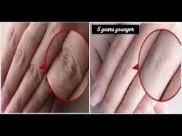 How To Make Your Hands Look 5 Years Younger Overnight Wrinkle Free Smoo Get Soft Fair And Youthful Hands Th Wrinkle Free Skin Face Wrinkles Wrinkles Hands