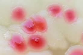 Pink Mold Is It Dangerous And How To Get Rid Of It