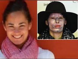 Maybe you would like to learn more about one of these? Natalia Ponce De Leon Antes Y Despues Del Ataque Con Acido Youtube