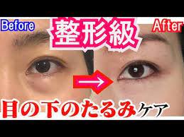 絶対変われる目の下のたるみをとるマッサージ エクササイズで顔が根本から生まれ変わる夜のケア youtube フェイスケア 顔のエクササイズ 目の下