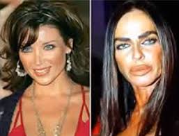 It is almost expected for women in hollywood to get plastic surgery in order to improve their looks or to stay looking young. 17 Celebrity Before And After Plastic Surgery Disasters