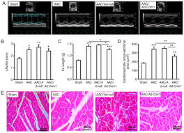 Crim1 Suppresses Left Ventricular Hypertrophy Corrigendum In 10 3892 Br 2019 1241