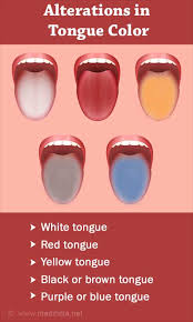 Image result for brown tongue symptoms