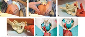 Image result for Manual Rotation in Occipitoposterior Presentation